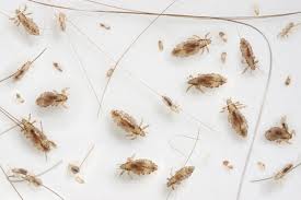 Image of the Sizes of Head Lice - Learn All About Lice Sizes of Head Lice Image - Science for Kids All About Lice