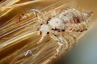 Image of a Head Louse Up Close Head Louse Up Close Image